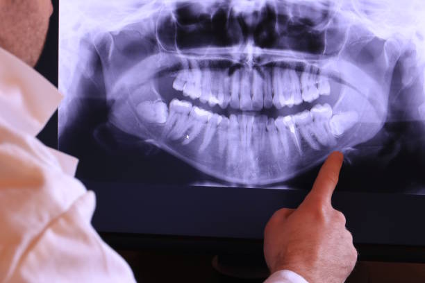 Best Root Canal Emergency Dentist  in Port Republic, NJ