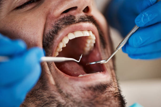 Best Cracked Tooth Emergency Dentist  in Port Republic, NJ